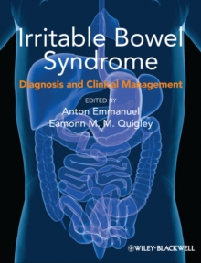 Irritable Bowel Syndrome : Diagnosis and Clinical Management, Paperback / softback Book Irritable Bowel Syndrome : Diagnosis and Clinical Management, Paperback / softback Book