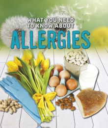 What You Need to Know About Allergies, Hardback Book What You Need to Know About Allergies, Hardback Book