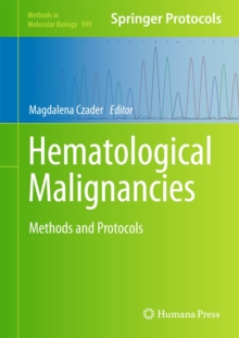Hematological Malignancies, Hardback Book Hematological Malignancies, Hardback Book